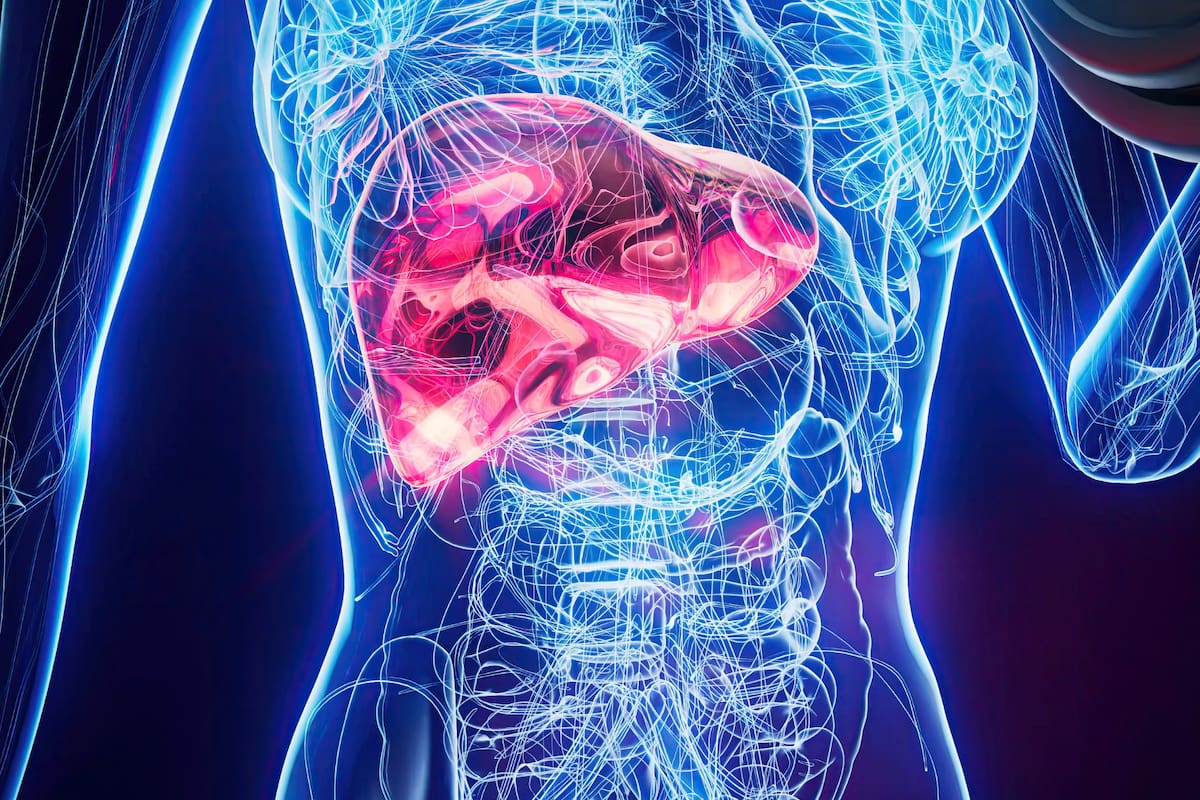Chau hígado graso: los mejores alimentos para limpiar el cuerpo de forma natural, según especialistas
