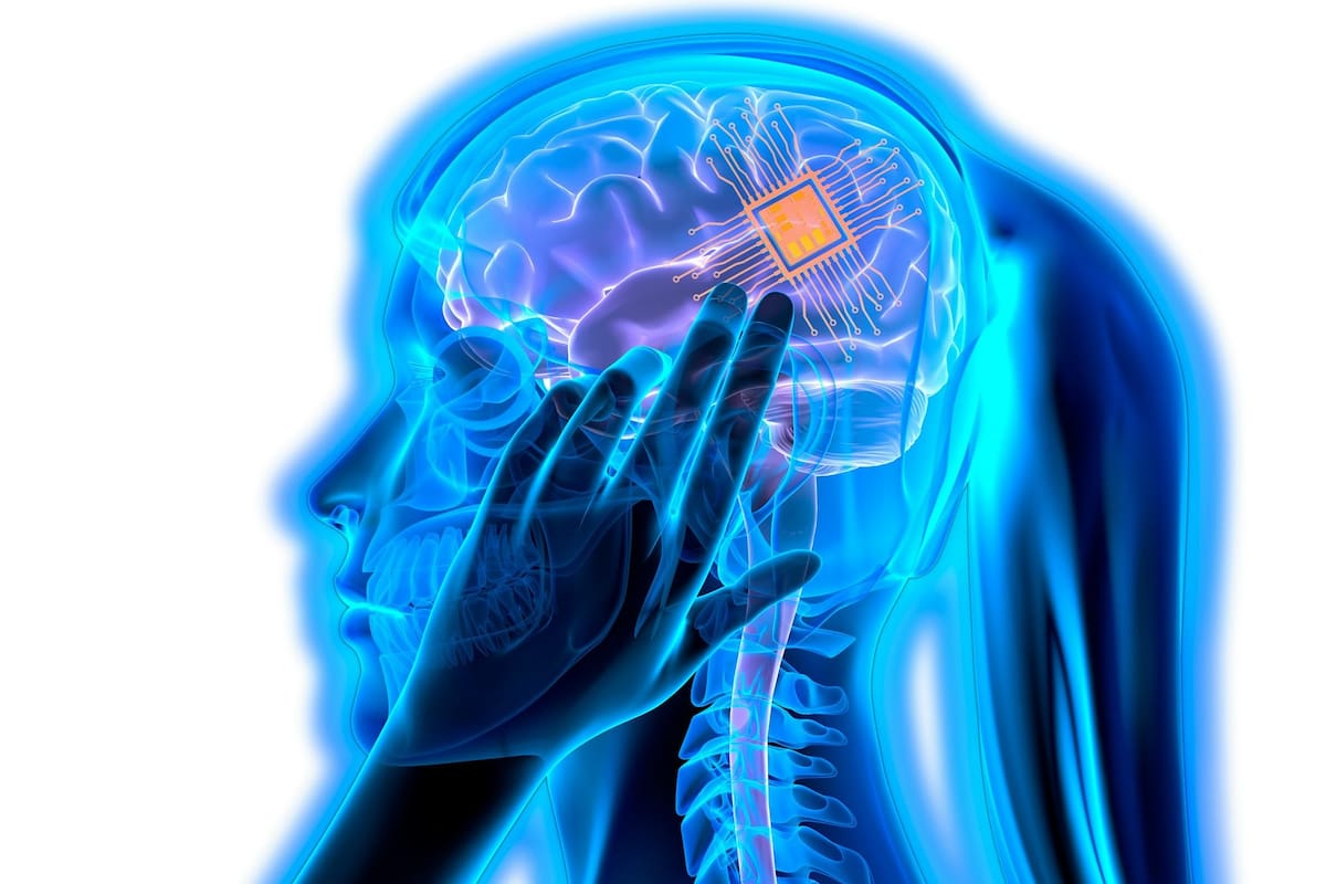 China aprueba el primer chip cerebral de venta comercial, llamado NEO