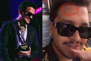 Christian Nodal tomó una decisión con uno de los tatuajes que se había hecho en honor a su exprometida, Belinda
