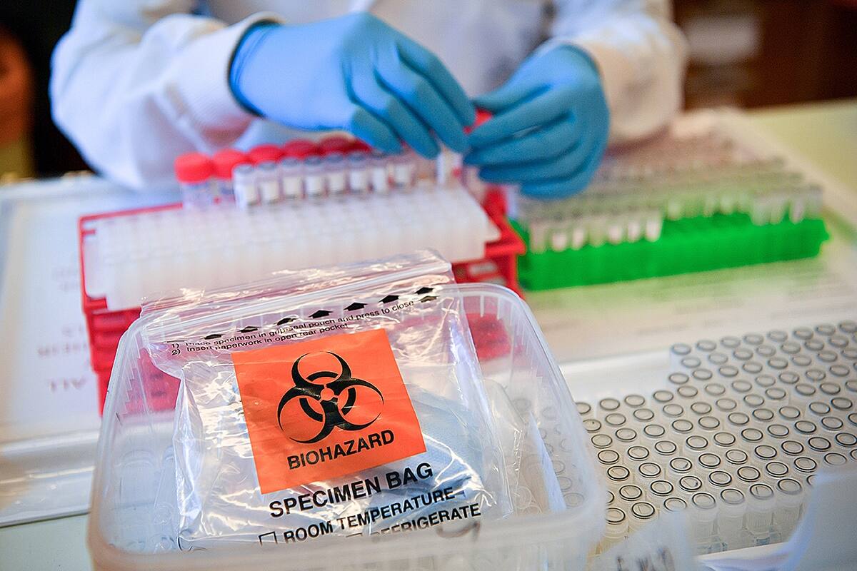 Científicos británicos frenaron hoy un gran ensayo médico tras hallar que el fármaco contra la malaria hidroxicloroquina era "inútil"