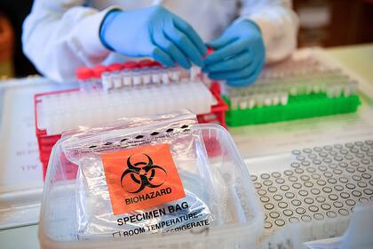 Científicos británicos frenaron hoy un gran ensayo médico tras hallar que el fármaco contra la malaria hidroxicloroquina era "inútil"