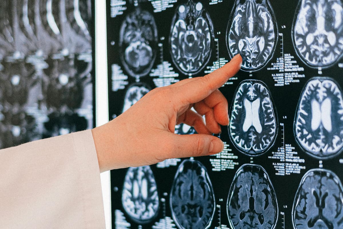 Científicos descubrieron cómo mejoraría la memoria en adultos mayores con un simple tratamiento