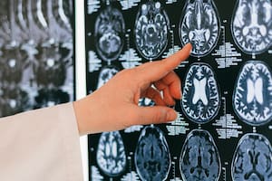 Científicos descubrieron cómo mejoraría la memoria en adultos mayores con un simple tratamiento