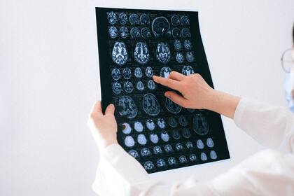 Científicos hallaron un gen en el cerebro (Foto Pexels)