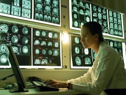 Científicos han observado cómo el alcohol puede afectar el desarrollo del cerebro en jóvenes de menos de 25 años