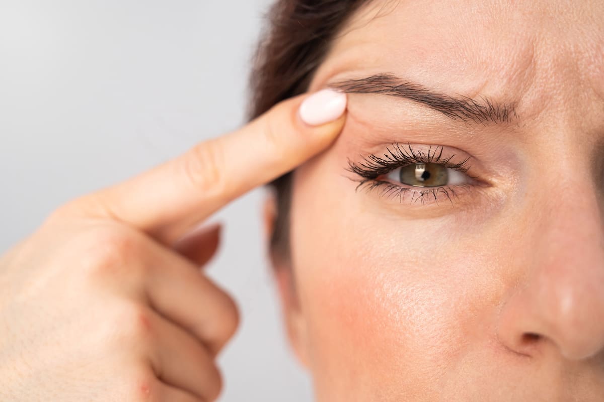 Close-up portrait of Caucasian middle-aged woman pointing to the wrinkles on the upper eyelid. Signs of aging on the face