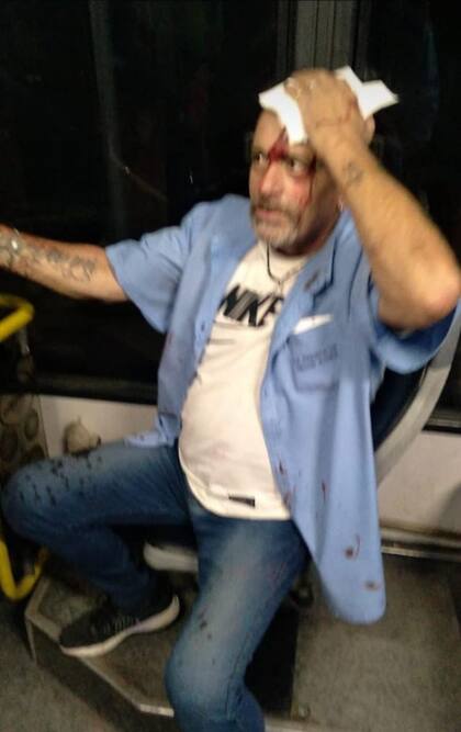Colectivero golpeado en Grand Bourg