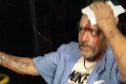 Colectivero herido en Grand Bourg