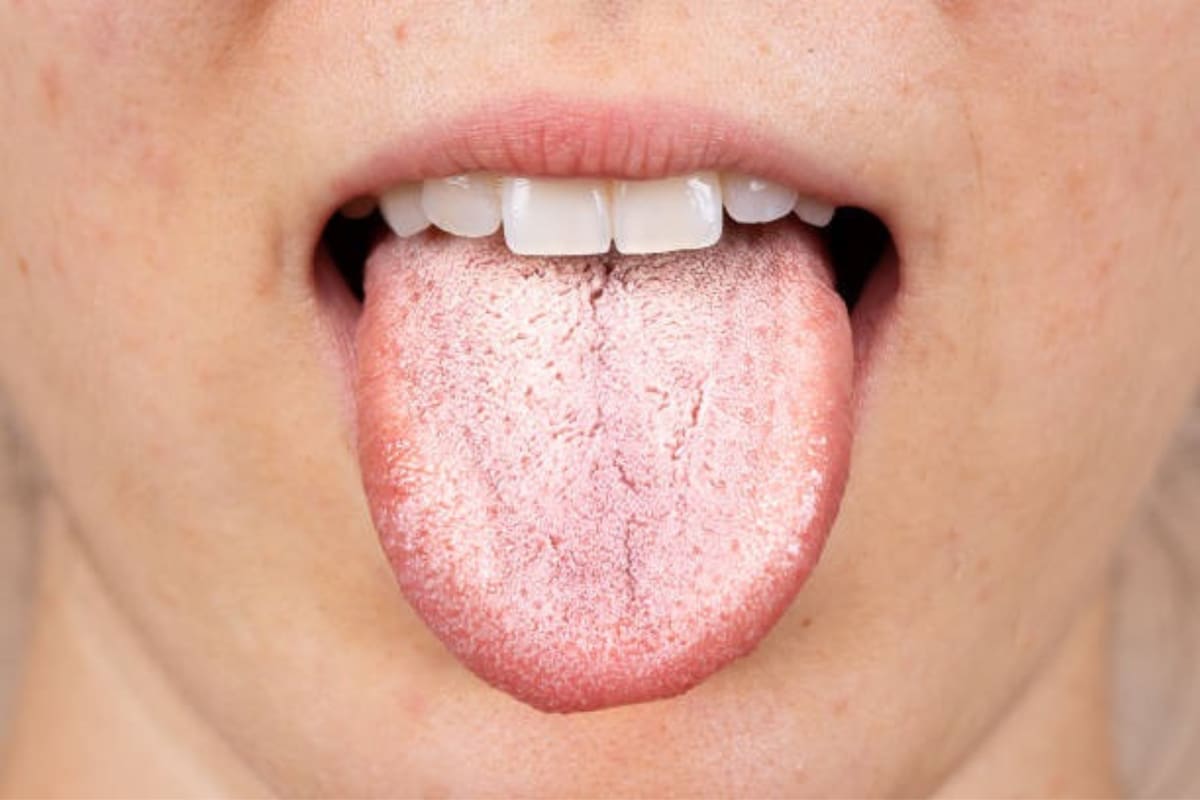 Cómo el aspecto de tu lengua podría revelar algún otro problema de salud en el organismo