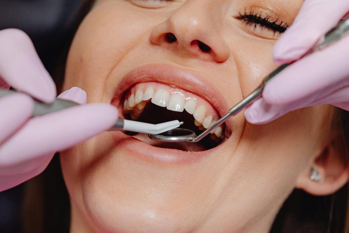 Cómo eliminar el sarro de los dientes