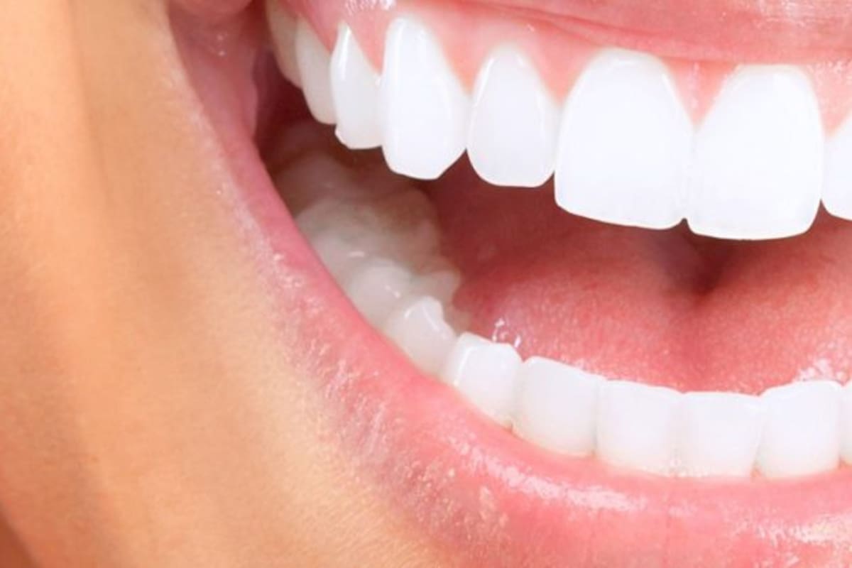 Cómo eliminar el sarro de los dientes para dejarlos blancos con un método fácil y casero