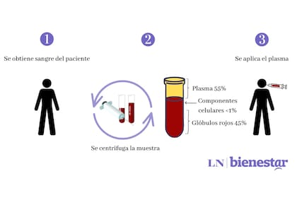 Cómo es el proceso de la aplicación de plasma rico en plaquetas en la cara