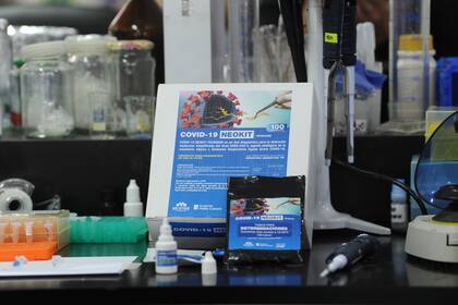 Cómo es el test de diagnóstico creado en el país