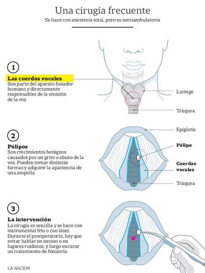 Cómo es la operación