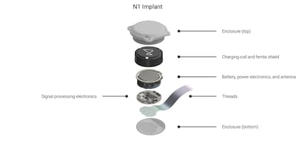 Cómo es un chip Neuralink por dentro