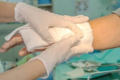 Cómo prevenir quemaduras en casa durante el invierno y qué hacer en caso de accidente con calor o fuego