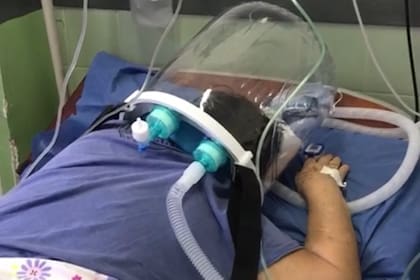 Con la administración de oxígeno, los pacientes se colocan boca abajo para mejorar la oxigenación en sangre
