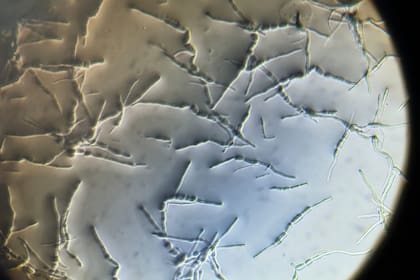 Conidios de Septoria resistentes germinando aún en presencia de estrobilurinas