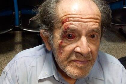 Córdoba. Un jubilado terminó internado por un golpe de un guardia de seguridad