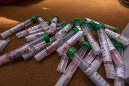 Como con los test queremos detectar los anticuerpos que producimos, la muestra que se recoge es una gota de sangre.