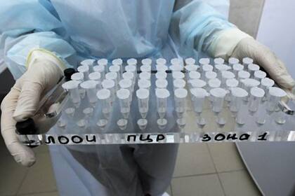 Un biólogo sosteniendo muestras para hacer pruebas de covid-19.