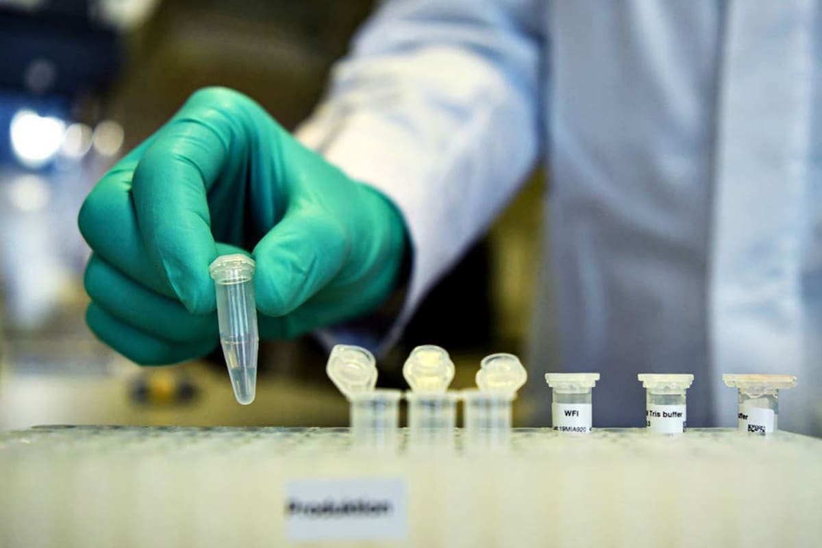 Coronavirus: denuncian que el Gobierno les da la espalda a los test de diagnóstico rápido del Conicet