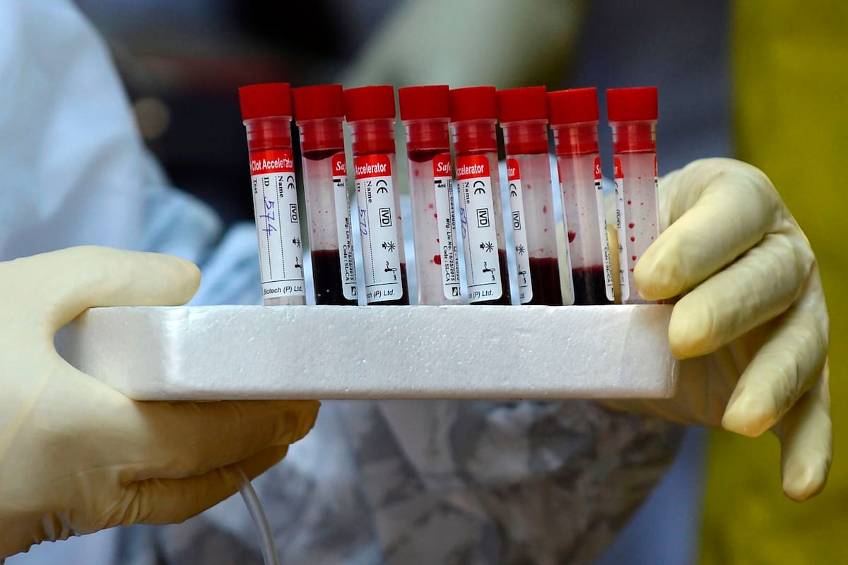 Coronavirus en la Argentina: ¿cuáles son los nuevos requisitos del Gobierno para viajar en combis?