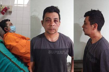 Coronavirus en Neuquén. Un enfermero fue atacado por un grupo de vecinos tras haberse recuperado