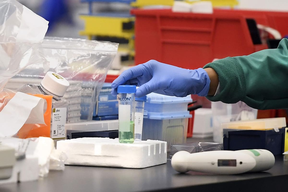 Coronavirus hoy en Estados Unidos: cuántos casos se registran al 3 de Abril