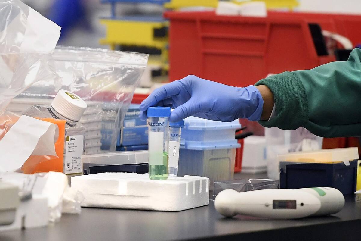 Coronavirus hoy en Uruguay: cuántos casos se registran al 3 de Abril