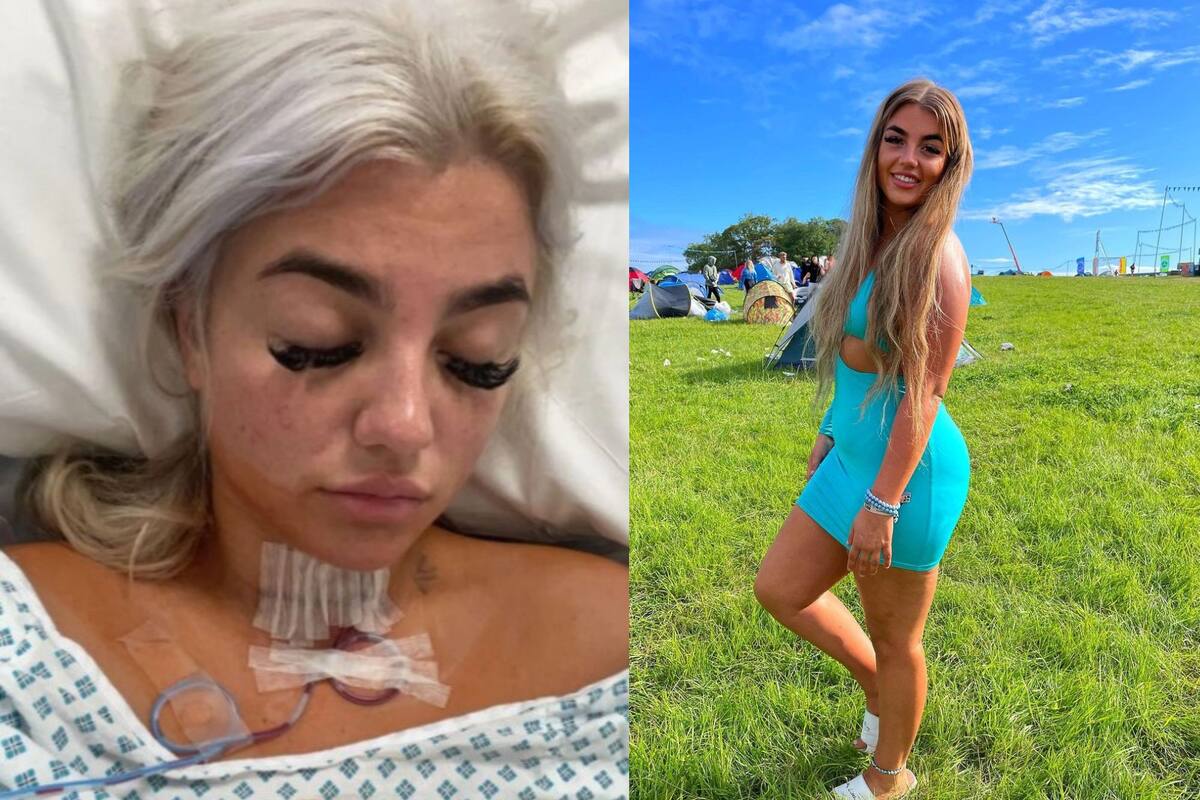 Courtney Nettleton, ciudadana de Reino Unido que tiene 20 años, comenzó a presentar signos “incontrolables” de cansancio extremo.