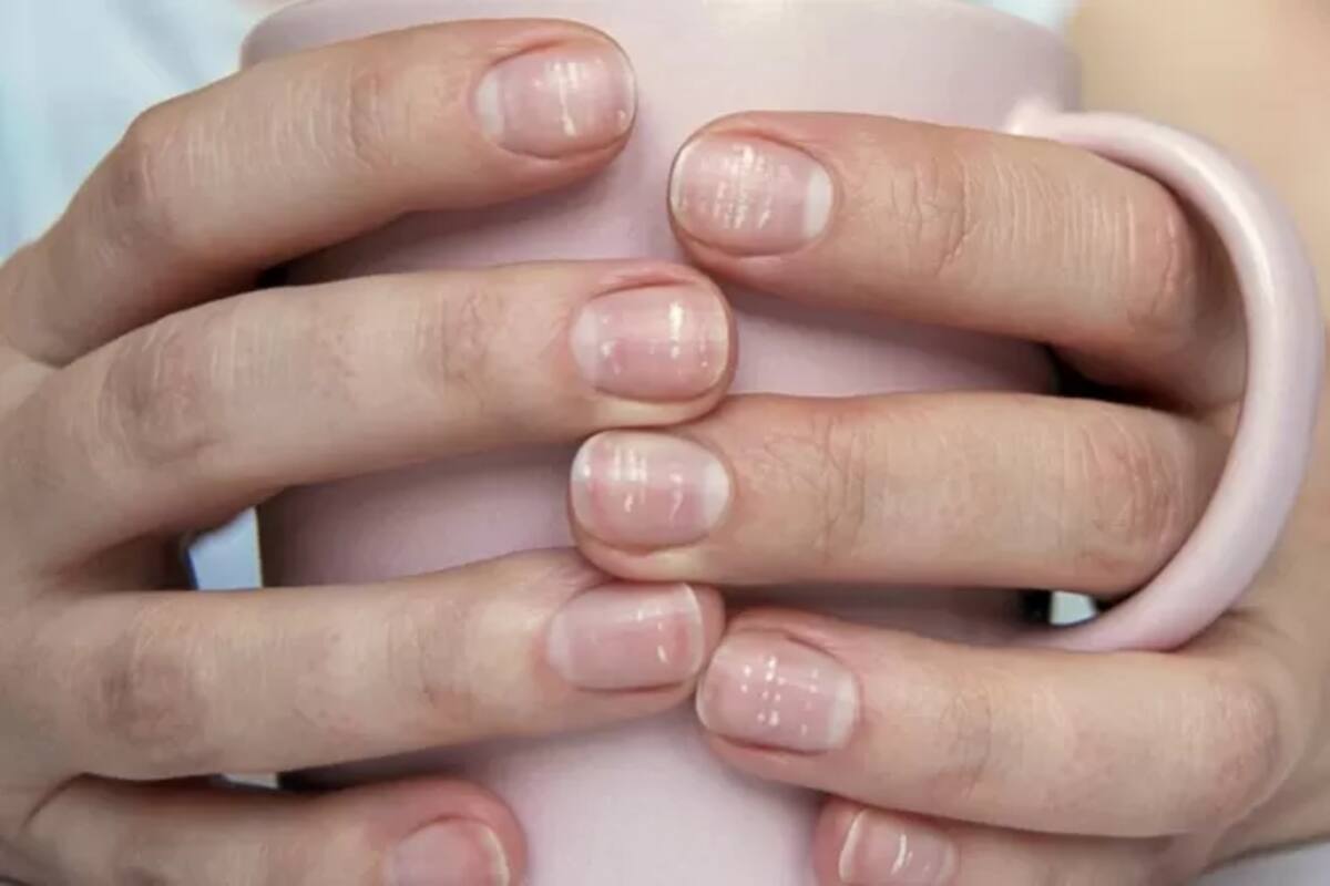 Covid-19: 4 extraños síntomas de coronavirus de los que quizás no hayas oído hablar