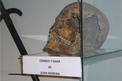 Craneo y daga de Juan Moreira
