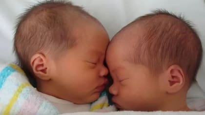 Cuando eran bebés Maddie y Mia eran consideradas mellizas, pero a los cuatro años resultaron ser gemelas (Foto: Claire Chow)