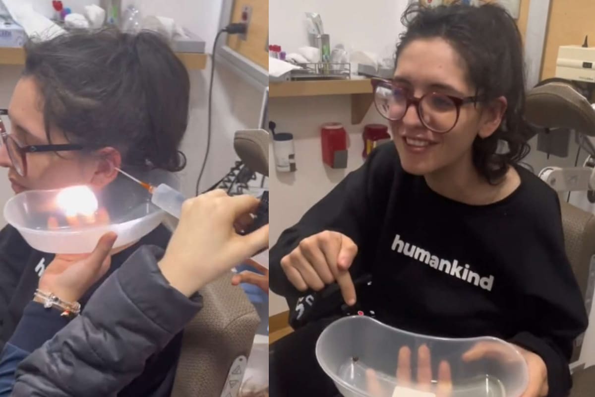 Cuando los especialistas descubrieron lo que había en su oído, ella no lo podía creer