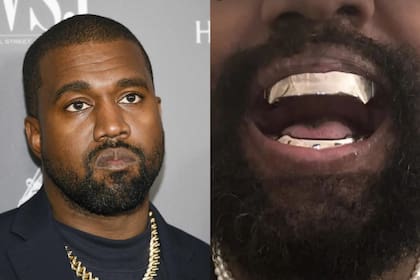 Cuántos miles de dólares gastó Kanye West en su nueva dentadura de titanio inspirado en Tiburón, un enemigo de James Bond