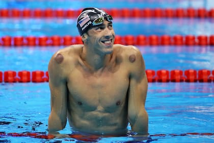 Cupping: Michael Phelps llamó la atención en los Juegos Olímpicos de 2016 en Río de Janeiro tras mostrarse con unos moretones circulares en distintas partes del cuerpo