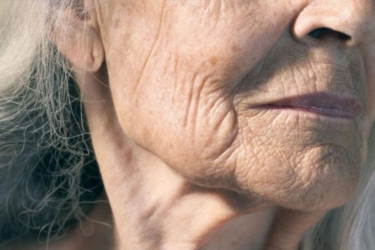 Curar quemaduras y heridas sin cicatrices, eliminar la calvice y hasta retrasar los signos del envejecimiento... algunos de los usos potenciales de este descubrimiento