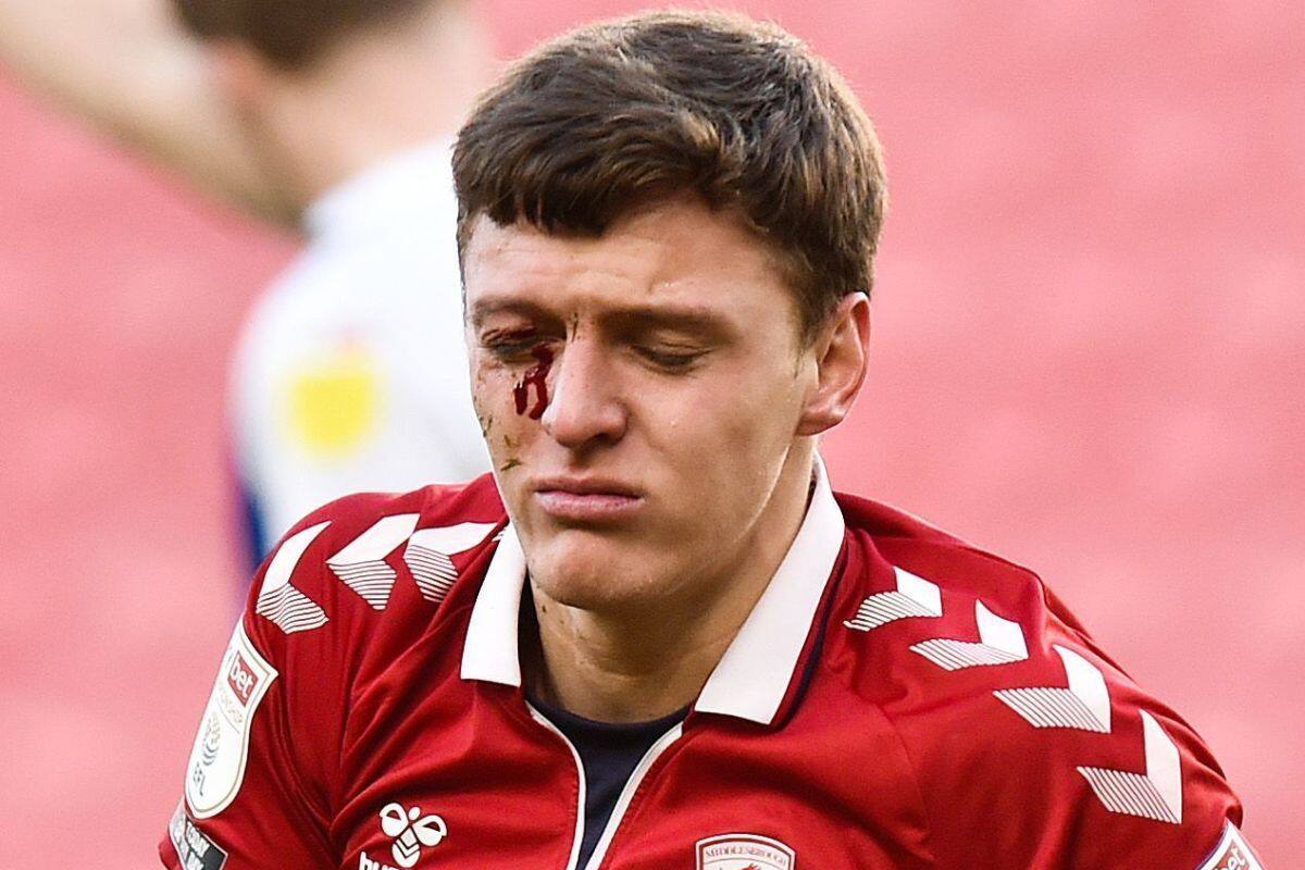 Dael Fry casi pierde un ojo al ir a cabecear