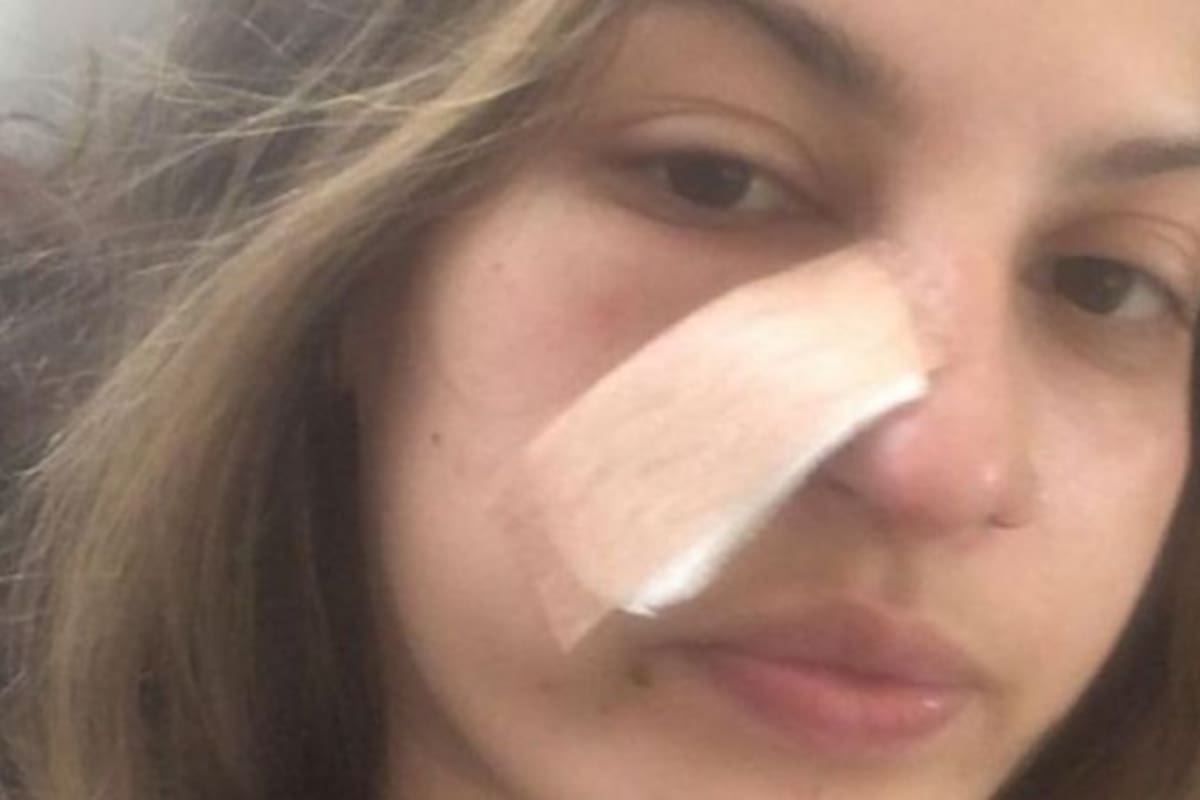 Daiane Lima descubrió de forma casual que sufría cáncer de piel