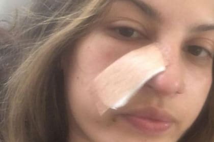 Daiane Lima descubrió de forma casual que sufría cáncer de piel