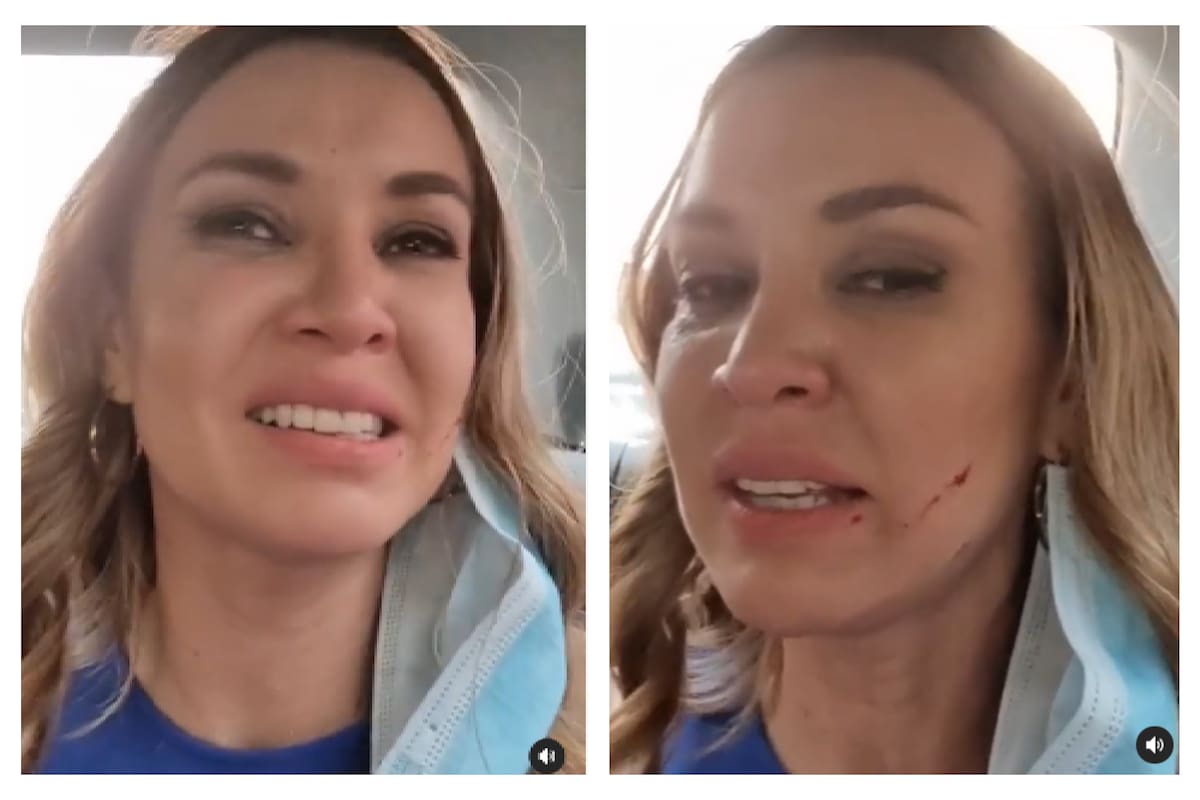 Dallys Ferreira tuvo que recibir asistencia médica luego de que una mujer desconocida la golpeara en Paraguay