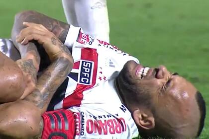 Dani Alves se fracturó el antebrazo derecho