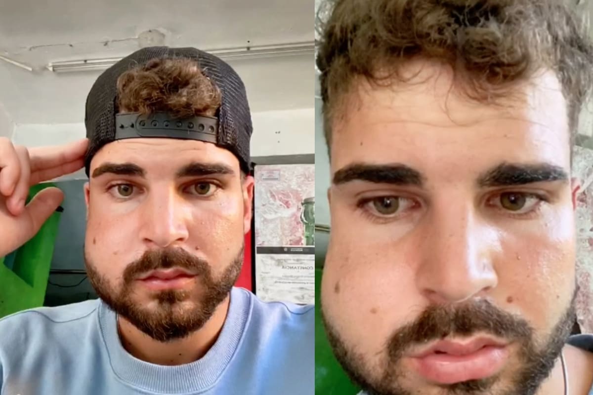 Dani Schepers sintió un fuerte dolor y decidió atenderse con un especialista local y al mirarse al espejo quedó sin palabras