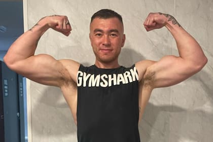 Dave Hartrey se volvió viral al mostrar en TikTok las consecuencias que sufrió su cuerpo por el uso de esteroides