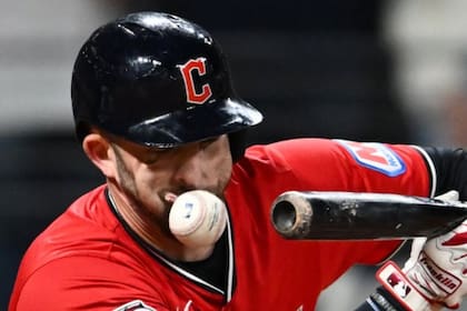 David Fry, bateador designado de los Cleveland Guardians, sufrió fracturas en la nariz y en la cara tras recibir un duro pelotazo