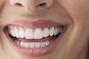 De acuerdo con la Asociación Dental Americana (ADA) el bicarbonato de sodio es seguro para los dientes, incluido el esmalte