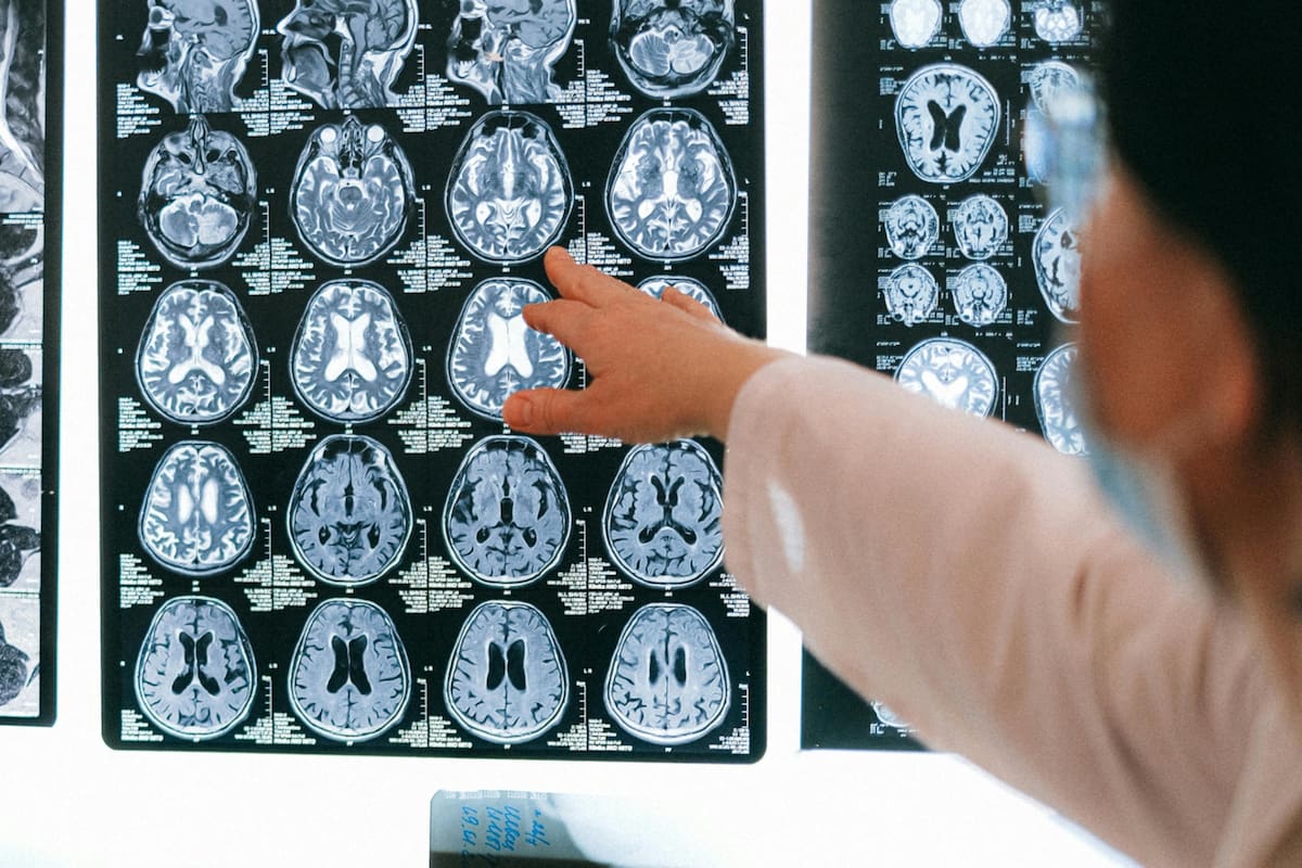 De acuerdo con los expertos, el magnesio puede mejorar la salud cognitiva