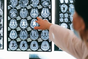 De acuerdo con los expertos, el magnesio puede mejorar la salud cognitiva