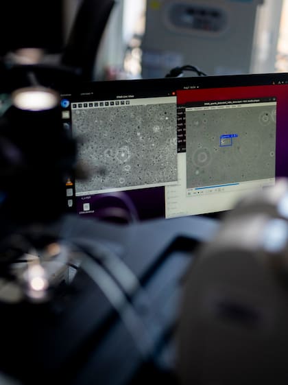 De manera similar a como los astrónomos usan algoritmos de aprendizaje automático para descubrir nuevos objetos en el cielo nocturno, este sistema utiliza inteligencia artificial para localizar espermatozoides difíciles de encontrar